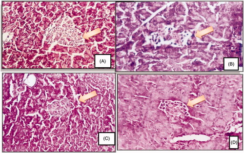Figure 1. Photomicrographs are representative of cross sections from six rats stained with hematoxylin and eosin. (A) showing pancreas of normal rat with normal pancreatic tissue including islets of Langerhans, pancreatic acini and ducts, (B) showing pancreas of diabetic rat with islet destruction, reduction in size and lymphocytic infiltration, (C) representing pancreas of Momordica charantia pretreated diabetic rat showing mild islets destruction, (D) showing pancreas of diabetic rat treated with Momordica charantia with moderate islet destruction (H&E 250×).