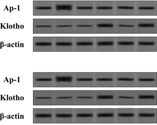 Figure 3 Expression levels of AP-1 and klotho proteins in the mixed culture of human fibroblasts and keratinocytes in the HA-S and HA-Y treated group and the control (Con) group tested by Western blot.