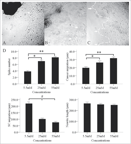 Figure 4. Enhancement of the interaction between PanCa cells and DRGs by high glucose levels. In the high-glucose group of 25 and 55mM, neurite outgrowth (A, arrow; original magnification, ×100) extended from the DRGs to tumor clusters and provided an invasive pathway for the clusters (B, arrow; original magnification, ×200). Cancer cells then formed more clusters (C, arrow; original magnification, ×100). In a co-culture model, the cancer cells formed spike-like morphological formations in the 3 groups of 5.5, 25 and 55 mM tested. Increased formation of spike-like structures and cluster migration to DRGs were detected in the high-glucose groups. High glucose concentrations inhibited SC migration but not neurite outgrowth (D). *P < 0.05 (5.5 mM versus 25 mM); **P < 0.01 (5.5 mM vs. 55 mM); #P < 0.05 (5.5 mM versus 25 mM and 55 mM).