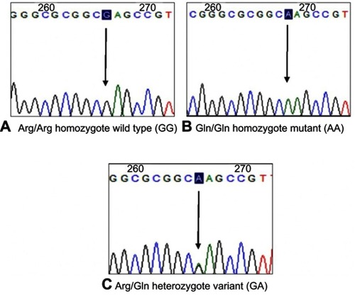 Figure 2 Sequencing results of the heterozygote Arg163Gln genotype of the MC1R gene polymorphisms.