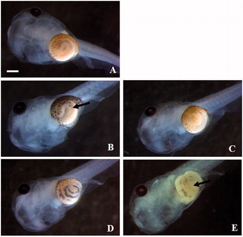 Figure 4. Xenopus laevis embryos at the end of the FETAX test. Ventral views of a control (A) and embryos exposed to 25 mg Fe/L of FeSO4 (B), FeCl3 (C), ZVI NPs (D) and Fe3O4 NPs (E). FeSO4 treated embryos show abnormal gut coiling (arrow) and the presence of dark material in the intestinal loops is appreciable in NP treated embryos (D and E). Bars = 500 µm.