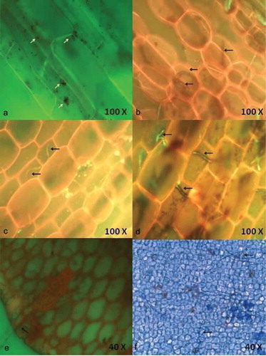 Figure 1. Localisation of endophytic fungi within seagrass tissue using 0.05% acridine orange (a-e) and Aniline blue (f) staining and the aero indicate the presence of fungal spores (a) and fungal hyphae in the cells.