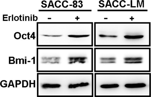 Figure 4 Erlotinib treatment increased the expression cancer stem cell markers. Western blot analyses for Oct4 and Bmi-1 were carried out in SACC-83 and SCC-LM cells treated with or without erlotinib for 3 days.