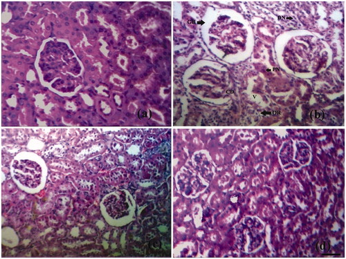 Figure 3. Histological appearance of kidney tissue in different groups. (a) Normal histological appearance of kidney tissues of control rat. (b) Histological appearance of kidney tissues of a diabetic rat. The section shows thickening of glomerular basement membrane (GB), occasional ruptures (OR), cytoplasmic debris (CD), desquamated nuclei (DN), vacuolization (V), and picnotic nuclei (P). (c) Histological appearance of kidney tissues of naringenin (5 mg/kg) treated diabetic rat. (d) Histological appearance of kidney tissues of naringenin (10 mg/kg) treated diabetic rat (H&E × 100; scale bars = 50 μm).