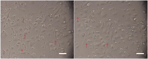 Figure 5. Morphology of mesenteric lymph nodes-dendritic cells (MLN-DCs).