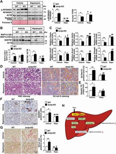 Figure 7. Induction of autophagy by MTORC1 inactivation suppresses MCD diet-induced hepatic steatosis, inflammation, and fibrosis in txnip-KO livers. WT and txnip-KO mice were fed an MCD diet for 4 w, with rapamycin (5 mg/kg/d) applied during the final week (n = 5–7 per group). (A) Western blot analysis of p-RPS6KB1, RPS6KB1, and nuclear TFEB. (B) Immunoblotting of MAP1LC3B and SQSTM1. (C) Hepatic expression of FAO-related genes. (D) H&E and Oil Red O staining. Scale bar: 50 μm. Ten fields (final magnification, × 400) were randomly selected for each sample, and the positive area in each image was measured. (E) Hepatic TG levels. (F) Immunohistochemical detection of ADGRE1 (arrow). Scale bar: 50 μm. Ten fields (final magnification, × 400) were randomly selected for each sample, and positive cells in each image were counted. (G) Sirius red staining. Ten fields (final magnification, × 400) were randomly selected for each sample, and the positive area in each image was measured. Scale bar: 50 μm. (H) A proposed model of TXNIP-mediated autophagy and FAO in NASH pathogenesis. In NASH, an elevated FFA flux upregulates TXNIP expression in hepatocytes. TXNIP promotes PRKAA phosphorylation, MTORC1 inactivation, and TFEB nuclear translocation, leading to autophagy induction and FAO. This could contribute to MCD diet-induced steatosis, inflammation, and fibrosis. Values represent means ± SEM. *P < 0.05, **P < 0.01 versus WT; #P < 0.05, ##P < 0.01 versus the same genotype control