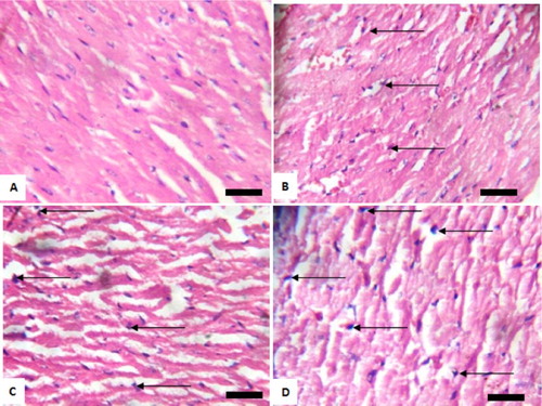 Figure 6. Photomicrograph showing heart of rats post withdrawal of sodium arsenite for 4 weeks. (A) Control; (B) 10 mg/kg NaAsO3 mild myocardial damage with pyknotic cells (black arrows); (C) 20 mg/kg NaAsO3 moderate myocardial damage with pyknotic cells (black arrows) and (D) 40 mg/kg NaAsO3 severe myocardial damage with pyknotic cells (black arrows). Scale bar (for A, B, C and D) = 2.15 × 2.79 mm. Plates are stained with H and E stained and viewed with ×100 objectives.