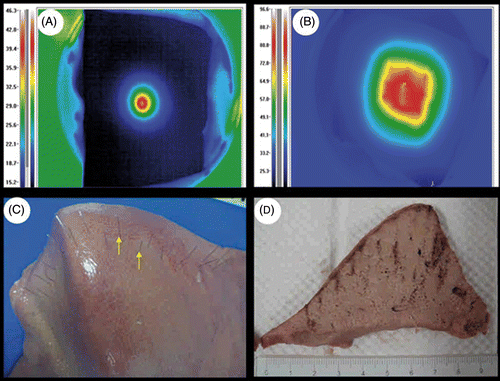 Figure 2. Ex vivo experiments: (A) and (B) temperature measurement by infrared imager. Note that in (A) a single needle was used, while in (B) nine needles were used; (B) produced a much higher temperature than (A). (C) An array of needles was inserted along the resection line over an isolated porcine liver with an interval of 5 mm between each other (arrow). (D) After a 3-min electromagnetic thermocoagulation, the cutting surface of the liver explant showed a completely ‘cooked’ appearance.