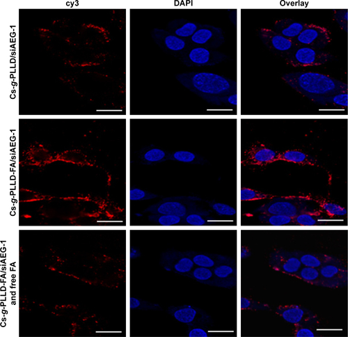 Figure S4 Confocal laser scanning microscope images of various complexes in U2OS cells after incubation for 4 hours.Notes: Image assignment: blue, nucleus; red, AEG-1 siRNA. The image on the right is an overlay of the two fluorescent colors (×1,000 magnification). Scale bar 50 μm.Abbreviations: FA, folic acid; PLLD, poly (L-lysine) dendrons; AEG-1, astrocyte elevated gene-1; Cs-g-PLLD-FA, a novel nanoscale polysaccharide derivative prepared by click conjugation of azido-modified chitosan with propargyl focal point PLLD and subsequent coupling with FA; DAPI, 4′,6′diamidino-2-phenylindole.