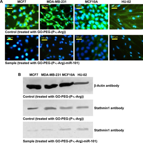 Figure 11 miR-101 overexpression suppressed stathmin1 expression in breast cancer cells. The protein level of stathmin1 was detected 48 h after treated cells with GO-PEG-(P-l-Arg)-miR-101 by ICC assay (A) and WB assay (B).Abbreviations: GO, graphene oxide; PEG, polyethylene glycol; P-l-Arg, poly-l-arginine; ICC, immunocytochemistry; WB, Western blotting.