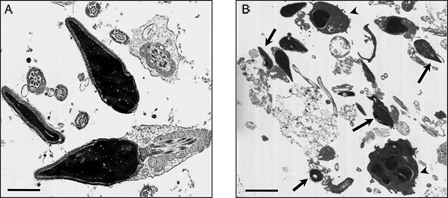 Figure 1. Transmission electron micrograph of human ejaculates from normozoospermic (A) and leukocytospermic (B) subjects. In (A) both longitudinal and cross-sections of sperm with normal ultrastructure are shown; in (B) sperm with altered shape, loss of acrosomal and plasma membrane, and disrupted chromatin (arrows) are clearly evident among leukocytes and macrophages (arrowheads). Bar: 1 µm (A); 5 µm (B).
