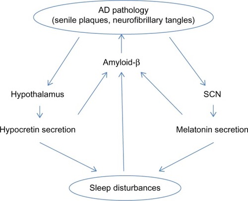 Figure 1 Bidirectional relationship between sleep and AD pathology.