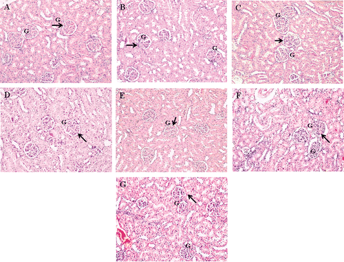 Figure 6.  Effect of different dosage MO flower and leaf extract as well as NAC on the kidney histological changes in APAP-induced hepatotoxicity in rats. Representative photographs show the histological changes in kidney tissues. Rats were sacrificed 24 h posttreatment, and all tissue sections were stained with hematoxylin and eosin (×200). a) Normal group; b) APAP-treated group (7 g/kg bw); c) APAP-treated group (7 g/kg bw) + NAC; d) APAP-treated group (7 g/kg bw) + MO flowers extract (200 mg/kg bw); e) APAP-treated group (7 g/kg bw) + MO flowers extract (400 mg/kg bw); f) APAP-treated group (7 g/kg bw) + MO leaves extract (200 mg/kg bw); g) APAP-treated group (7 g/kg bw) + MO leaves extract (400 mg/kg bw). The arrows indicate normal kidney architecture. G, glomeruli.