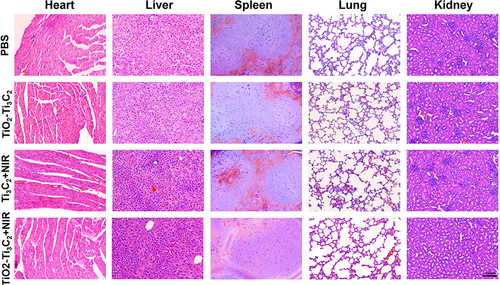 Figure 6 The biocompatibility of TiO2-Ti3C2. HE staining to assess the morphological changes in the heart, liver, spleen, lungs, and kidneys of mice.