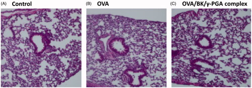 Figure 8. Lung micrograph after pulmonary administration of 5% glucose (A), OVA (B) and the OVA/BK/γ-PGA complex (C). Five percent glucose solution, OVA and the OVA/BK/γ-PGA complex were administered to mice. Twenty-four hours after administration, the mice were sacrificed and their lungs dissected. HE-stained sections of the lung were observed by microscopy at 20× magnification.