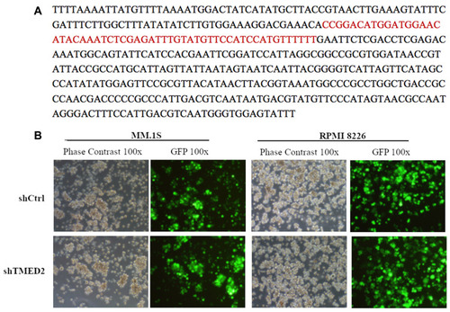 Figure 2 Establishment of stable TMED2-silenced MM.1S and RPMI 8226 cell lines. (A) The designed shRNA sequence was successfully incorporated into the lentivirus. (B) GFP expression in MM.1S and RPMI 8226 cells was detected using a fluorescence microscope (x100).