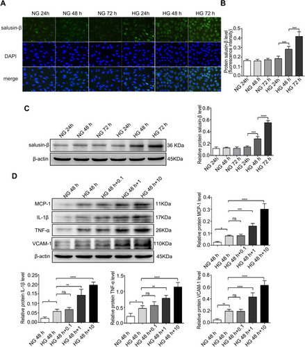 Figure 2 Expression levels of salusin-β at different time points and protein levels of pro-inflammatory cytokines after treatment with increasing concentrations of exogenous salusin-β. (A) After treatment with HG for 24 h, 48 h, and 72 h, the expression of salusin-β was measured by immunofluorescence. (B) Quantitative analysis of the salusin-β level based on the fluorescence intensity. (C) After treatment with HG for 24 h, 48 h, and 72 h, the expression level of salusin-β was analysed by Western blotting. (D) After treatment of HG-induced HRECs with increasing concentrations of salusin-β (0.1 nM, 1 nM, and 10 nM) for 48 h, the expression levels of MCP-1, IL-1β, TNF-α, and VCAM-1 were analysed by Western blotting. One-way ANOVA with Tukey’s test was used to assess the differences among the groups. n=3. *p<0.05, **p<0.01, ***p<0.001, ****p<0.0001.