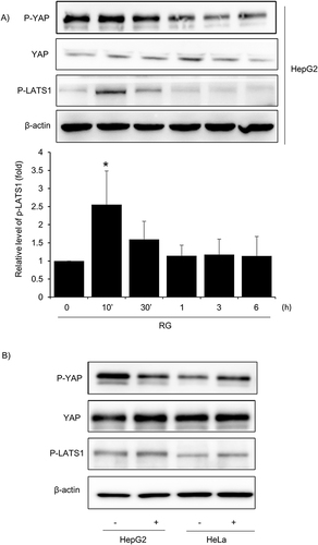 Figure 6 Effect of red RG on YAP signal. (A) Phosphorylation of YAP and LATS1. Immunoblot analysis was performed on HepG2 cells treated with RG (1000 μg/mL) over time. (B) Effects of RG on YAP and LATS1in LKB1-deficient HeLa cells determined by Western blotting. Data are pre-sented as mean of replicate samples with error bars representing standard deviation (vs control *p < 0.05).