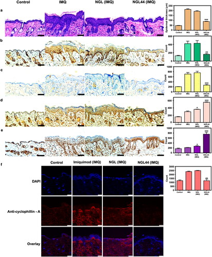 Figure 5. Immunohistochemical analysis of the psoriasiform lesions after treatment of the nanogels: (a) H&E staining; (b) Ki67; (c) Ly6G; (d) 8-OHDG; (e) HMGB1; (f) Cyclophilin A. Scale bar represents 100 μm for (a–e) and 75 μm for (f). All data are expressed as mean and SEM (n = 6). **p < .01 ***p < .001, compared with respective control groups. SEM: scanning electron microscopy.