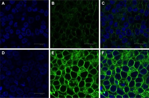 Figure 7 Confocal microscopy images of Caco-2 cells following incubation with coumarin-6 loaded (A–C) conventional (Lipo-Cou) liposomes and (D–F) OPC liposomes (OPC-Lipo-Cou).Notes: Images (A and D) demonstrate cell nuclei stained with TO-PRO-3 (blue), images (B and E) show cell cytoplasm with accumulated liposomal coumarin-6, and images (C and F) show merged images. Scale shown is 50 µM.