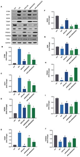 Figure 5 APS regulates the protein expression levels of oxidative stress-related genes in H9C2 cells. (A) Representative Western blot images. (B–J) Bar graphs showing the protein expression levels of CYBA, NCF1, NOX4, TXNIP, SOD2, GSR, PRDX3, TXNRD2 and TXN1 in cultured cells with or without APS treatment. Values are presented as mean ± SEM. The two-group analysis was performed using the independent samples t-test between HG and ctrl, siRNASOD2 and ctrl, APS-HG and HG, APS-siRNASOD2 and siRNASOD2. *P<0.05 vs ctrl, #P<0.05 vs HG, and !P<0.05 vs siRNASOD2, corresponding to all the repetitions in the study.