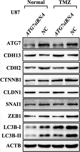 Figure 4D-R: The repeated Western blotting of the related proteins in Figure 4D.