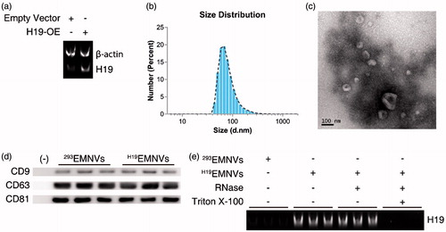 Figure 1. Preparation and characterization of EMNVs. (a) PAGE analysis immediately after RT-PCR in HEK-293 cells transfected with empty vector or H19-OE. (b) The size distribution of EMNVs directly tracked using a DLS system. (c) Representative TEM images of EMNVs; scale bar, 100 nm. (d) Western blot analysis of CD9, CD63 and CD81. (e) PAGE analysis immediately after RT-PCR (initial total RNA content of each sample set as 100 ng) in 293EMNVs and H19EMNVs treated with RNase (2 mg/mL) alone or combined with Triton X-100 (0.1%) for 15 min.