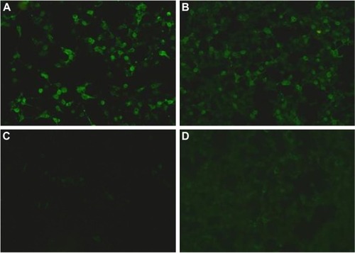 Figure 1 Anti-NMDA receptor antibodies in patient’s cerebrospinal fluid and serum. Anti-NMDA receptor antibodies were positive in cerebrospinal fluid (IgG, 1:32) (A) and serum (IgG, 1:320) (B) before immunotherapy. The level of anti-NMDA receptor antibodies significantly decreased in cerebrospinal fluid (IgG, 1:3.2) (C) and serum (IgG, 1:32) (D) after 5 months of immunotherapy.