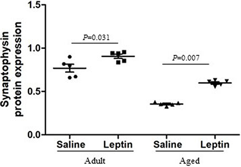 Figure 3 Semi-quantitative analysis of synaptophysin expression in the adult + leptin group, adult + saline group, aged + leptin group and aged + saline group.