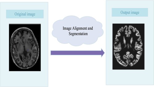 Figure 2. Image alignment using affine transformation.