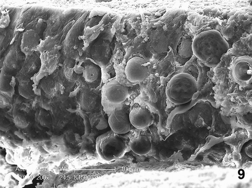 Figure 9. Scanning electron microscopy showing circular indentations on the mucosal surface of the phallus associated with numerous trichodinid ciliates. Bar = 100 µm.