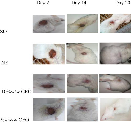 Figure 8 Wound area of burn wound on day 2, 14, and 20.