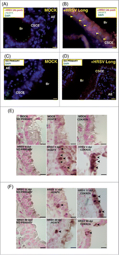 Figure 5. Expression of markers of DNA damage and aging in lungs of mice infected by HRSV. (A) Epithelial lung tissue from mock-infected mice stained with antibodies: αHRSV (pool of antibodies against HRSV) and γH2AFX. (B) Representative image of multiple immunofluorescence labeling with αHRSV and γH2AFX antibodies of lung tissue from HRSV-infected mice stained. (C), (D) Representative images of negative controls (no primary) of the multiple immunofluorescence labeling of epithelial lung tissue. Magnifications: 600X; scale bar: 10 μm. Arrowheads signal cells showing reactivity to γH2AFX. AE: alveolar epithelium, Br: bronchiole, CSCE: ciliated simple columnar epithelium. (E) Representative images of conventional immunohistochemistry of γ-H2AFX and CDKN2A on mice lung tissue (mock-infected or infected with HRSV) at 4 days post-infection. (F) Representative images of conventional immunohistochemistry of γH2AFX and CDKN2A on mice lung tissue at 11 and 30 days post-infection. Arrowheads signal cells showing reactivity to γH2AFX and CDKN2A. Two experiments, n = 5 (mock-infected) or 6 (infected) replicates (mice) per condition.
