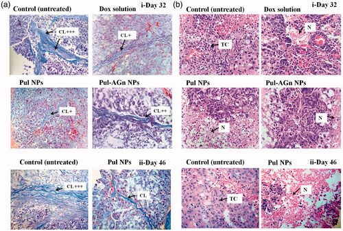 Figure 4. (a) Tumor sections were stained with Masson’s trichrome on day 32(i) and day 46 (ii) post first dose – the blue color represents collagen content. Original magnifications 400×. The collagen content was quantified using ImageJ and normalized to control (CL – collagen), (b) Images of H&E-stained tumor, sections excised from liver tumor-bearing mice following treatment with Dox formulations on day 32 (i) and day 46 (ii) post first dose. Original magnifications 400 × (TC – tumor cells with large prominent nuclei; N – necrotic cell mass).