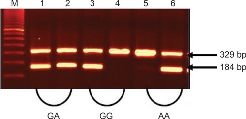 Figure 1 The amplification of TNF-α (−308G/A) genotypes (GG, GA, and AA).Notes: Lane M: 100 bp DNA marker. Lanes 1, 3, and 5: amplification of allele G. Lanes 2,4, and 6: amplification of allele A. A184 bp band for target DNA and 329 bp band for internal control were used.Abbreviation: TNF-α, tumor necrosis factor-alpha.