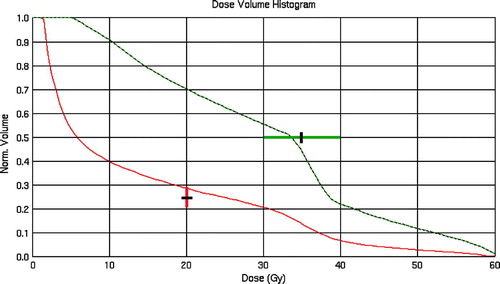 Figure 1C.  Cumulative dose volume histograms for the entire ipsilateral lung (red) and for regions with post-RT density changes (green-dashed) (Normalized volumes; typical total lung volume about 1 200 ml and volume with density changes about 20 ml). The red vertical line illustrates the mean V20 value (±SD) for all 48 irradiated, mastectomized patients. The green horizontal line depicts the average mean dose (± SD) of the damaged lung subvolumes among the mastectomized patients with post-RT lung density changes.
