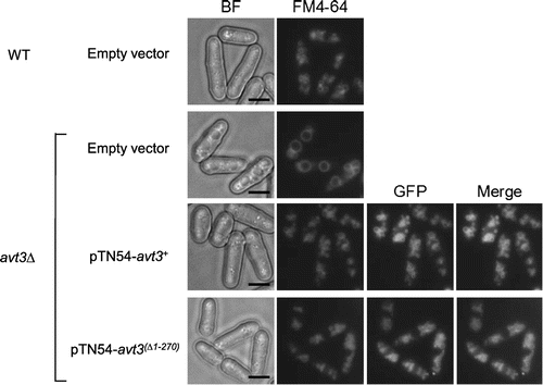 Fig. 2. Effect of deletion of the N-terminal region of Avt3p on its subcellular localization and vacuolar morphology in S. pombe cells.