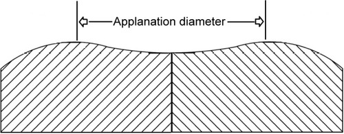 Figure 2 CATS tonometer prism cross section of the modified applanating surface.