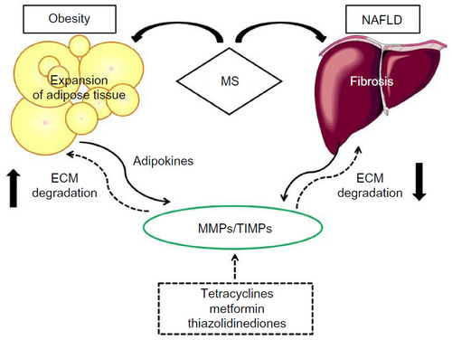 Figure 1 Relationship between MS, obesity and NAFLD, and MMPs/TIMPs balance.