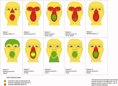 Figure 1. Affected anatomical facial regions.