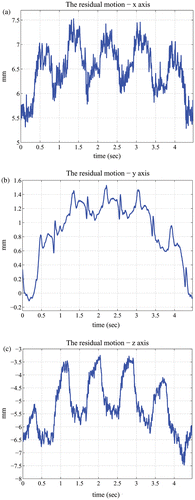 Figure 2. The residual motion of the heart during a respiratory cycle when using the Octopus TE.