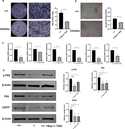 Figure 7. Odonto/osteogenic differentiation in NF-κB-inhibited EMSCs. (a) Under induction with dental epithelium conditioned medium for 7 days, ALP staining was used to detect the potential of odonto/osteogenic differentiation in p75NTR+/+EMSCs group and p75NTR+/+EMSCs-inhibitor group. ALP activities of p75NTR+/+EMSCs-inhibitor was significantly lower compared with p75NTR+/+EMSCs. (b) Alizarin red staining was used to detect the potential of odonto/osteogenic differentiation in p75NTR+/+EMSCs group and p75NTR+/+EMSCs-inhibitor group. Calcium quantification illustrated the higher calcium deposition in p75NTR+/+EMSCs compared with p75NTR+/+EMSCs-inhibitor group. (c) RT-PCR for the detection of DSPP, Runx2, DMP1, ALP, OCN and OSX of EMSCs, respectively, p75NTR+/+ EMSCs, p75NTR−/− EMSCs, and p75NTR+/+ EMSCs + inhibitor groups at day 7. (d) After 7 days of induction, the expression levels of P65, p-P65 and DSPP were detected by western blot, β-Actin used as the reference gene. Semiquantitative analysis demonstrated that the expression odonto /osteogenic marker (DSPP) was significantly downregulated in NF-κB pathway-inhibited EMSCs than those in control group at day 7. The data are presented as mean ± SD, n = 3, *P < 0.05, **P < .01, ***P < .001. Scale bar, 100 μm.