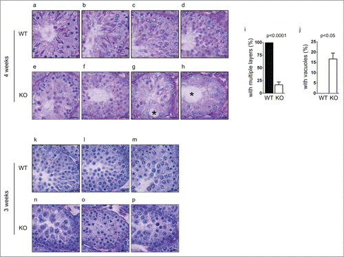 Figure 4. Spermatogenesis in Chfr knockout male mice with small testes are delayed at 3 and 4 weeks. Testis sections of 3 and 4-week-old male mice were stained with periodic acid schiff (PAS)-hematoxylin. Typical pictures of normal testes from WT male mice (a-d for 4 weeks and k-m for 3 weeks) and small testes from Chfr knockout male mice (e-h for 4 weeks and n-p for 3 weeks) are shown. Scale bar, 50 µM. Asterisk: large vacuoles. (i-j) For 4-week-old male mice, seminiferous tubules with multiple layers of germs cells (i) and with large vacuoles (j) are summarized. Mean and standard deviation are shown.