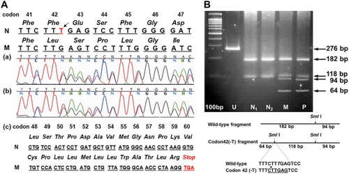 Figure 1. Molecular identification of Hb Yala (c.129delT) in a Thai family, (A) Direct genomic sequencing reveals T-deletion (black arrow) at the codon 42 of the β-globin gene in patient (a) and her mother (b) resulting in a generation of new termination codon (TGA) at codon 60 ((c) and the lower panel). The protein sequences are shown in italic. N = normal genomic sequence; M = mutant genomic sequence. (B) Confirmation for the novel mutation using the PCR-based analysis. A schematic diagram shows the generation of a new restriction enzyme site of Sml I by codon 42 (-T) in the amplified β-globin gene fragment from both patient (P) and her mother (M). This PCR-RFLP fragment was not observed in normal controls (N1 and N2). U, undigested PCR products.