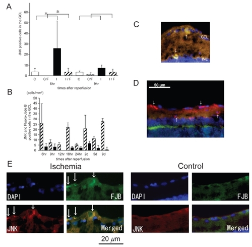 Figure 7 Expression of p-JNK in ischemic retinas and the time course of the number of p-JNK positive cells in the GCL. The numbers of p-JNK positive cells and p-JNK/Fluoro-Jade B positive cells in the ischemic retinas were significantly increased compared to those of the control retinas only after 6 hours of reperfusion (A). Less than one-half of the p-JNK-positive cells were also Fluoro-Jade B-positive (B). The sections were obtained from ischemic retinas 6 hours after reperfusion (C–E). The expression of p-JNK co-existed with Fluoro-Jade B-positive cells in the GCL and the INL (arrows) (C) (merged) and (E) (multi panel). However, many type of cells with no Fluoro-Jade B positive signals were p-JNK-positive (D) (merged). Thus, JNK may play different roles in ischemic retinas as well as neuronal degeneration. (A); White bars showed the number of p-JNK positive cells in the control retinas and checked bars showed the number of p-JNK positive and Fluoro-Jade B positive cells in the control retinas. Black bars showed the number of p-JNK positive cells in the ischemic retinas and stripe bars showed p-JNK positive and Fluoro-Jade B positive cells in the ischemic retinas.