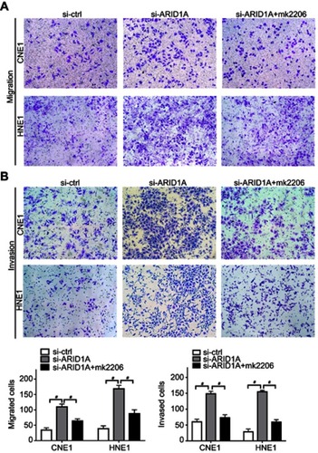 Figure 6 MK-2206 partially rescued the enhanced migration and invasion ability induced by ARID1A silencing in NPC cells. (A–C). MK-2206 inhibited the motility (A) and invasion (B) of ARID1A-silenced NPC cells.# P<0.001.Abbreviations: NPC, nasopharyngeal carcinoma; ARID1A, AT-rich interacting domain-containing protein 1A.