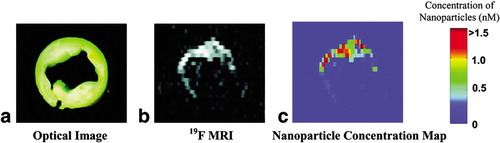 Figure 5. An application of a high‐density lipoprotein (HDL)‐like nanoparticle contrast agent for macrophage‐targeted in vivo magnetic resonance imaging (MRI). Phospholipid‐based contrast agent Gd‐DTPA‐DMPE and NBD‐DPPE‐labelled phospholipid for fluorescence confocal microscopy were used for the reconstruction of HDL. The MR images of an apolipoprotein E knockout mouse at 1.5 T illustrate the pre‐ and 24 h post‐injection of contrast agent at a rHDL dose of 4.36 μmol/kg. White arrows point to the abdominal aorta; the insets denote a magnification of the aorta region. (Modified from Frias et al. 2004 Citation52 with permission.)