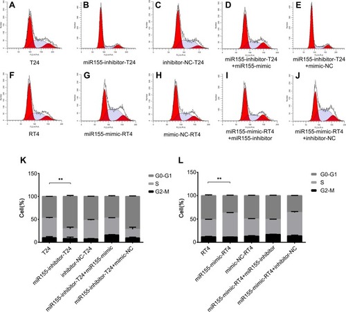 Figure 2 MiR-155 induced cell cycle re-distribution in T24 and RT4 cells.Notes: A, B, C, D and E represent T24 group, miR155-inhibitor-T24 group, inhibitor-NC-T24 group, miR155-inhibitor-T24+miR155-mimic group and miR155-inhibitor-T24+mimic-NC group. F, G, H, I and J represent RT4 group, miR155-mimic-RT4 group, mimic-NC-RT4 group, miR155-mimic-RT4+miR155-inhibitor group and miR155-mimic-RT4+inhibitor-NC group. Compared to the T24 group, more cells were arrested in G0-G1 phase, and less cells were in the S phase in the miR155-inhibitor-T24 group (K). Cells in miR155-mimic-RT4 group accumulated in the S phase and decreased in G0-G1 phase compared to the original RT4 group (L). ** p < 0.001.