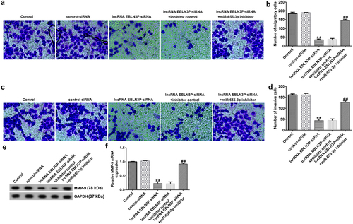 Figure 5. LncRNA EBLN3P knockdown inhibits invasion and migration of Jurkat cells by upregulating miR-655-3p.