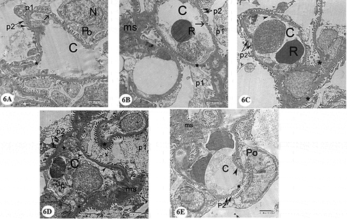 Figure 6. Electron micrographs of a portion of renal corpuscle: (A) and (B) Control group showing capillary in the glomerulus (C) with fenestrated endothelium lining (arrow) with uniform lamina densa bordered on each side with lamina rara (*), red blood cell(R). Podocyte cell (Po) with folded nucleus(N) gives primary process (p1) and numerous secondary processes (p2) separated by filtration slits. Note mesangial cell surrounded by mesangial matrix (ms). (C) and (D) Gentamicin treated group showing the capillary in a glomerulus (C) that is lined with distorted endothelium (arrow heads) with irregular thickening of the basement membrane (*), distorted secondary processes of podocytes (p2). Note electron dense mesangial matrix (ms). (E) Gentamicin and AGE cotreated group demonstrating glomerular capillary (C) with fenestrated endothelium (arrowhead). Note the presence of more or less normal basement membrane structure (*) and secondary processes of podocytes (p2) separated by filtration slits, podocyte (Po) and mesangial matrix (ms). (x 4800)